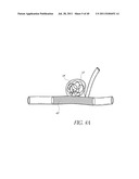 VASCULAR REMODELING DEVICE diagram and image