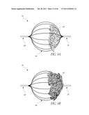 VASCULAR REMODELING DEVICE diagram and image