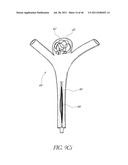 VASCULAR REMODELING DEVICE diagram and image