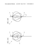 VASCULAR REMODELING DEVICE diagram and image