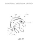 VASCULAR REMODELING DEVICE diagram and image