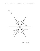 VASCULAR REMODELING DEVICE diagram and image