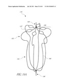 VASCULAR REMODELING DEVICE diagram and image