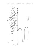 VASCULAR AND BODILY DUCT TREATMENT DEVICES AND METHODS diagram and image