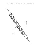 VASCULAR AND BODILY DUCT TREATMENT DEVICES AND METHODS diagram and image