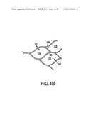 VASCULAR AND BODILY DUCT TREATMENT DEVICES AND METHODS diagram and image