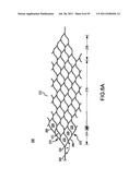 VASCULAR AND BODILY DUCT TREATMENT DEVICES AND METHODS diagram and image