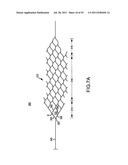 VASCULAR AND BODILY DUCT TREATMENT DEVICES AND METHODS diagram and image