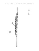 VASCULAR AND BODILY DUCT TREATMENT DEVICES AND METHODS diagram and image