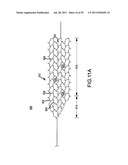 VASCULAR AND BODILY DUCT TREATMENT DEVICES AND METHODS diagram and image