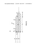 VASCULAR AND BODILY DUCT TREATMENT DEVICES AND METHODS diagram and image