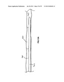 VASCULAR AND BODILY DUCT TREATMENT DEVICES AND METHODS diagram and image