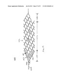 VASCULAR AND BODILY DUCT TREATMENT DEVICES AND METHODS diagram and image