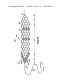 VASCULAR AND BODILY DUCT TREATMENT DEVICES AND METHODS diagram and image