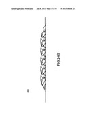 VASCULAR AND BODILY DUCT TREATMENT DEVICES AND METHODS diagram and image