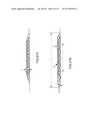 VASCULAR AND BODILY DUCT TREATMENT DEVICES AND METHODS diagram and image