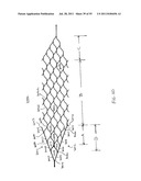 VASCULAR AND BODILY DUCT TREATMENT DEVICES AND METHODS diagram and image