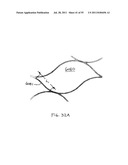 VASCULAR AND BODILY DUCT TREATMENT DEVICES AND METHODS diagram and image