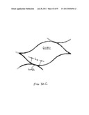 VASCULAR AND BODILY DUCT TREATMENT DEVICES AND METHODS diagram and image