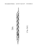 VASCULAR AND BODILY DUCT TREATMENT DEVICES AND METHODS diagram and image