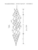 VASCULAR AND BODILY DUCT TREATMENT DEVICES AND METHODS diagram and image