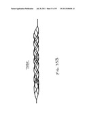 VASCULAR AND BODILY DUCT TREATMENT DEVICES AND METHODS diagram and image