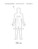 SYSTEM AND METHOD FOR COMMUNICATING INFORMATION BETWEEN IMPLANTABLE     DEVICES diagram and image