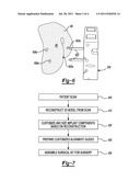 PATIENT-MODIFIED IMPLANT diagram and image