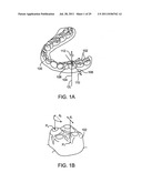 CLINICIAN REVIEW OF AN ORTHODONTIC TREATMENT PLAN AND APPLIANCE diagram and image