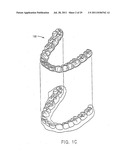 CLINICIAN REVIEW OF AN ORTHODONTIC TREATMENT PLAN AND APPLIANCE diagram and image