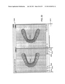 CLINICIAN REVIEW OF AN ORTHODONTIC TREATMENT PLAN AND APPLIANCE diagram and image