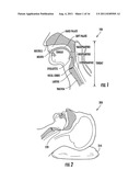METHODS FOR USING HEAD POSITIONING PILLOWS TO OPTIMIZE RESPIRATORY     TITRATION diagram and image