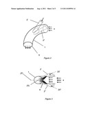 OXYCOMBUSTION CHAMBER diagram and image