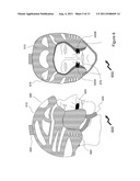 Breathing Apparatus diagram and image