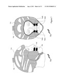 Breathing Apparatus diagram and image