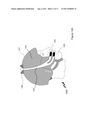 Breathing Apparatus diagram and image