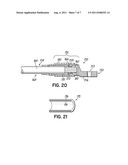 INTEGRAL BONDING ATTACHMENT diagram and image