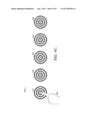 CONTRAST SENSITIVITY TESTING AND/OR TRAINING USING CIRCULAR CONTRAST ZONES diagram and image