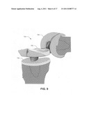 Input compensating for imaging distortion diagram and image