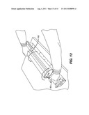 MOVABLE METERING SKIVE FOR A DEVELOPMENT STATION OF A REPRODUCTION     APPARATUS diagram and image