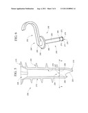 WALL ANCHOR SYSTEM diagram and image