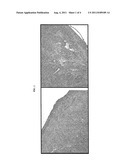 COMBINATION OF CD137 ANTIBODY AND CTLA-4 ANTIBODY FOR THE TREATMENT OF     PROLIFERATIVE DISEASES diagram and image