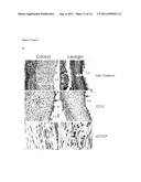 PHARMACEUTICAL COMPOSITIONS COMPRISING LIGNANS AND THEIR DERIVATIVES FOR     TREATING HYPERPLASTIC DISEASES diagram and image