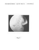 SURGICAL GRAFTS FOR REPAIRING CHONDRAL DEFECTS diagram and image