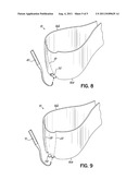 DENTAL MATRIX BAND diagram and image