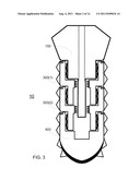 METHOD AND SYSTEM FOR DENTAL IMPLANTATION diagram and image