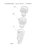 METHOD AND SYSTEM FOR DENTAL IMPLANTATION diagram and image