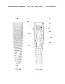 METHOD AND SYSTEM FOR DENTAL IMPLANTATION diagram and image