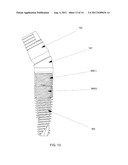 METHOD AND SYSTEM FOR DENTAL IMPLANTATION diagram and image