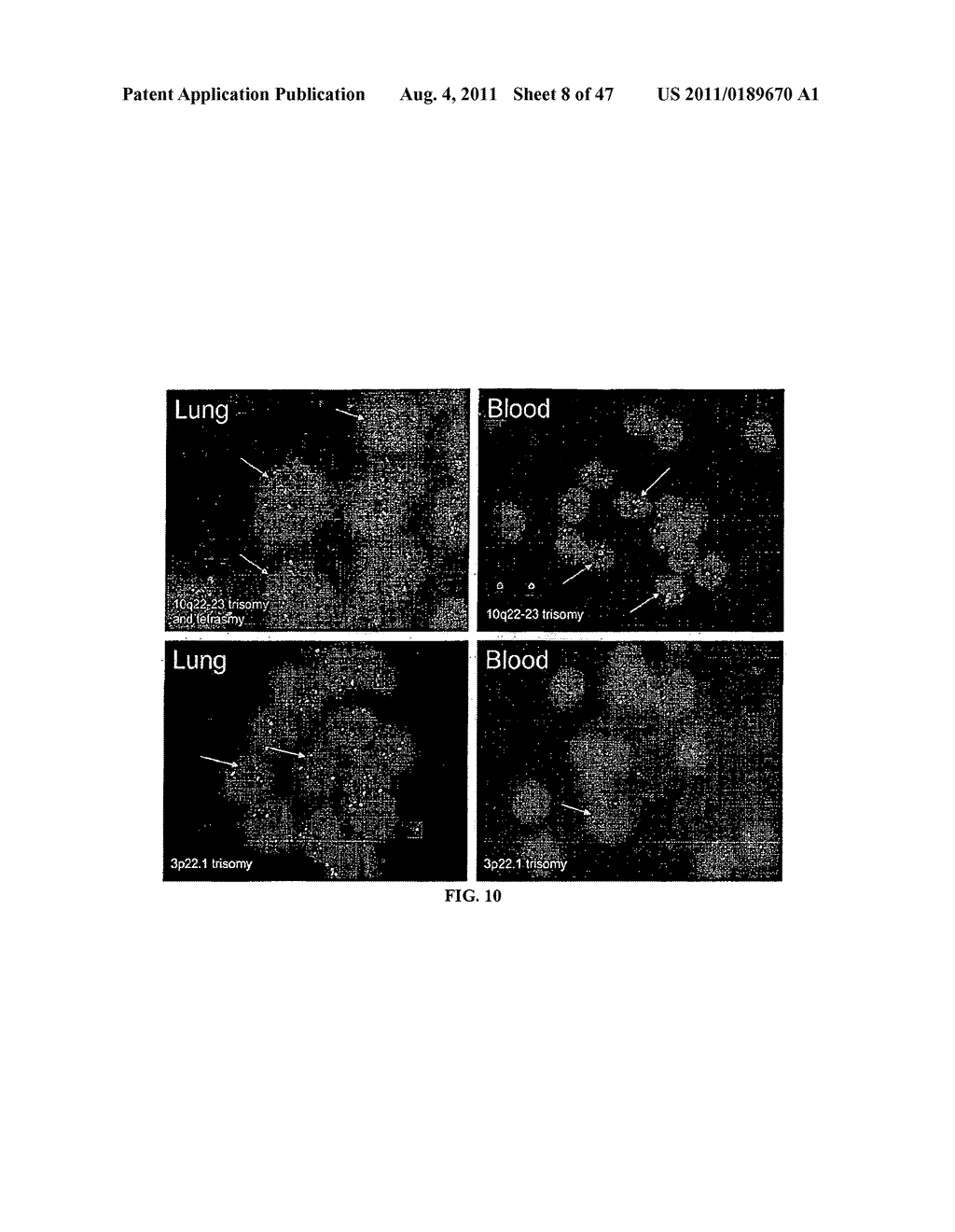 Circulating Tumor and Tumor Stem Cell Detection Using Genomic Specific     Probes - diagram, schematic, and image 09